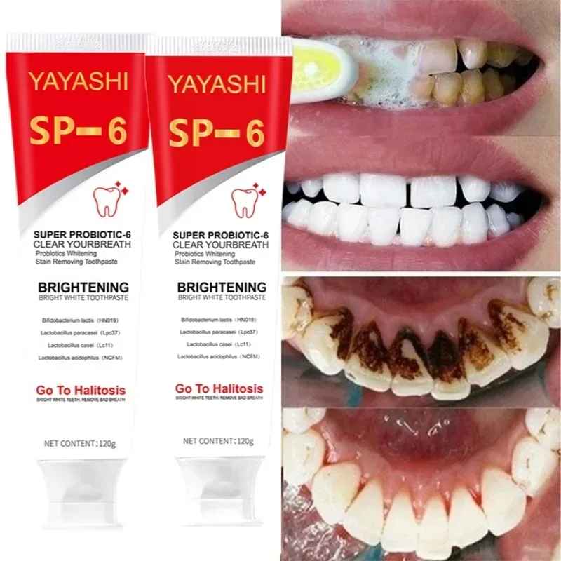 Teeth Whitening Toothpaste