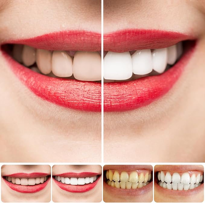 Teeth Whitening Toothpaste