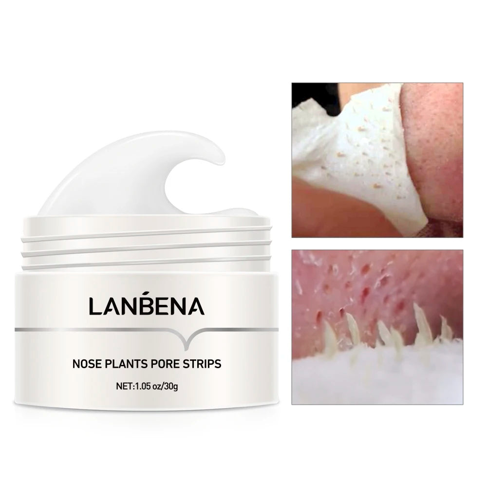 ''LANBENA'' Blackhead  remover