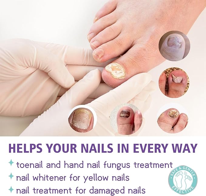 Special Nail care spray